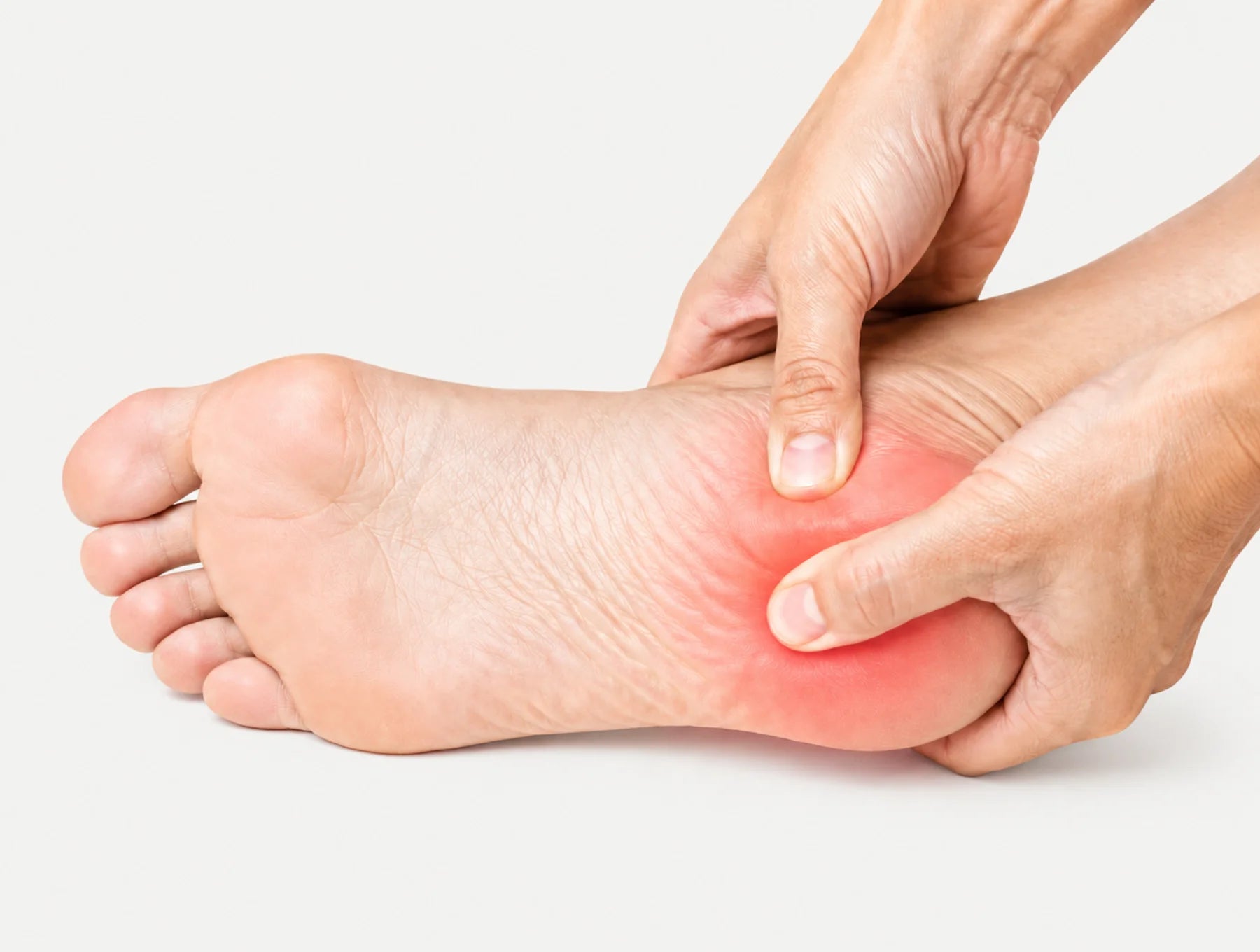 Plantar Fasciitis